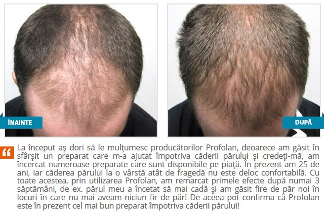Profolan Rezultate Dupa Folosire
