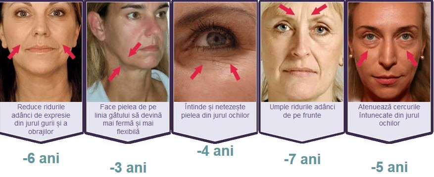 Rezultate cu Bioxelan 1